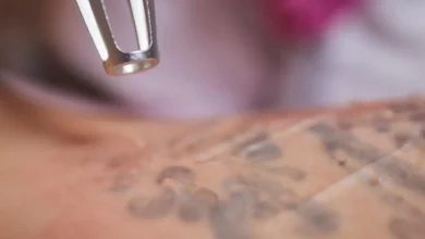 The Science Behind Tattoo Ink How It Impacts Removal Technique